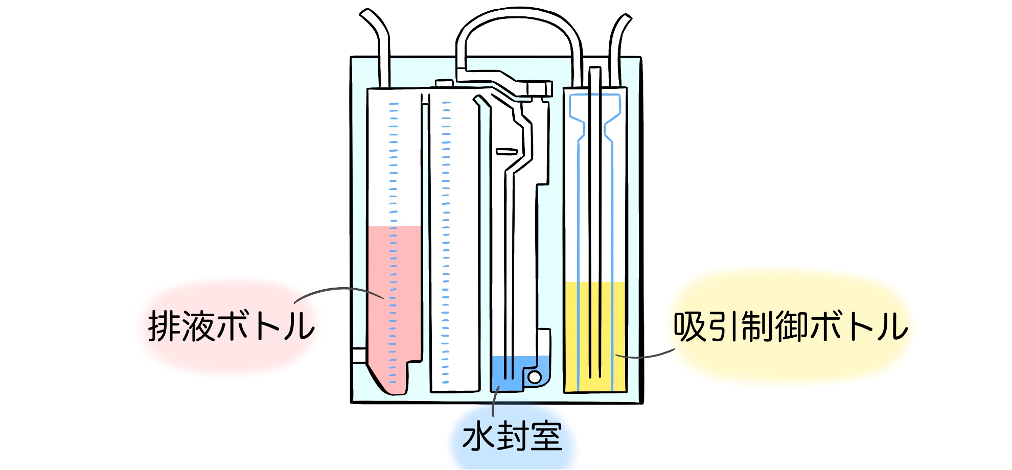 胸腔ドレナージの仕組み