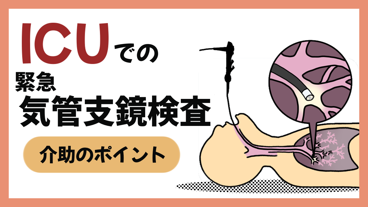 緊急気管支鏡検査、介助のポイント